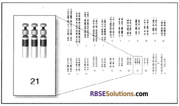 RBSE Solutions for Class 12 Biology Chapter 36 Man-Chromosomal Aberrations img 10