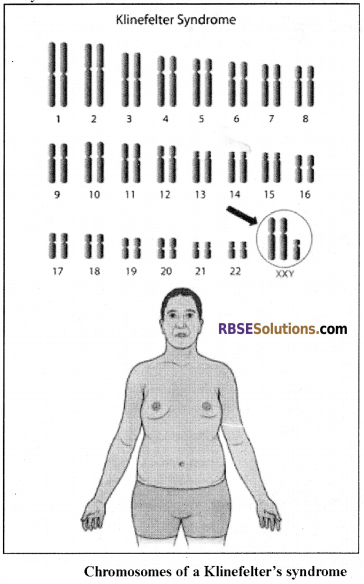 RBSE Solutions for Class 12 Biology Chapter 36 Man-Chromosomal Aberrations img 9
